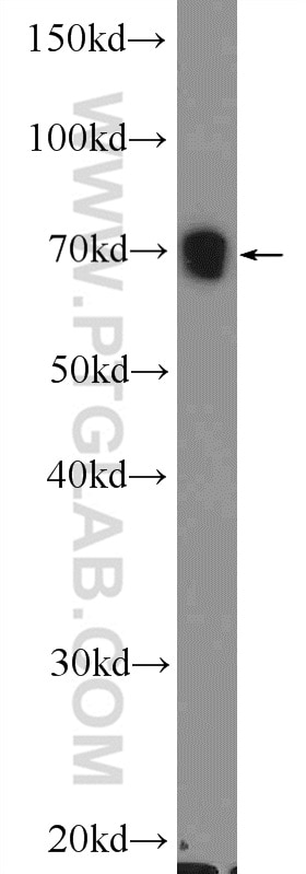 WNK4 Polyclonal antibody