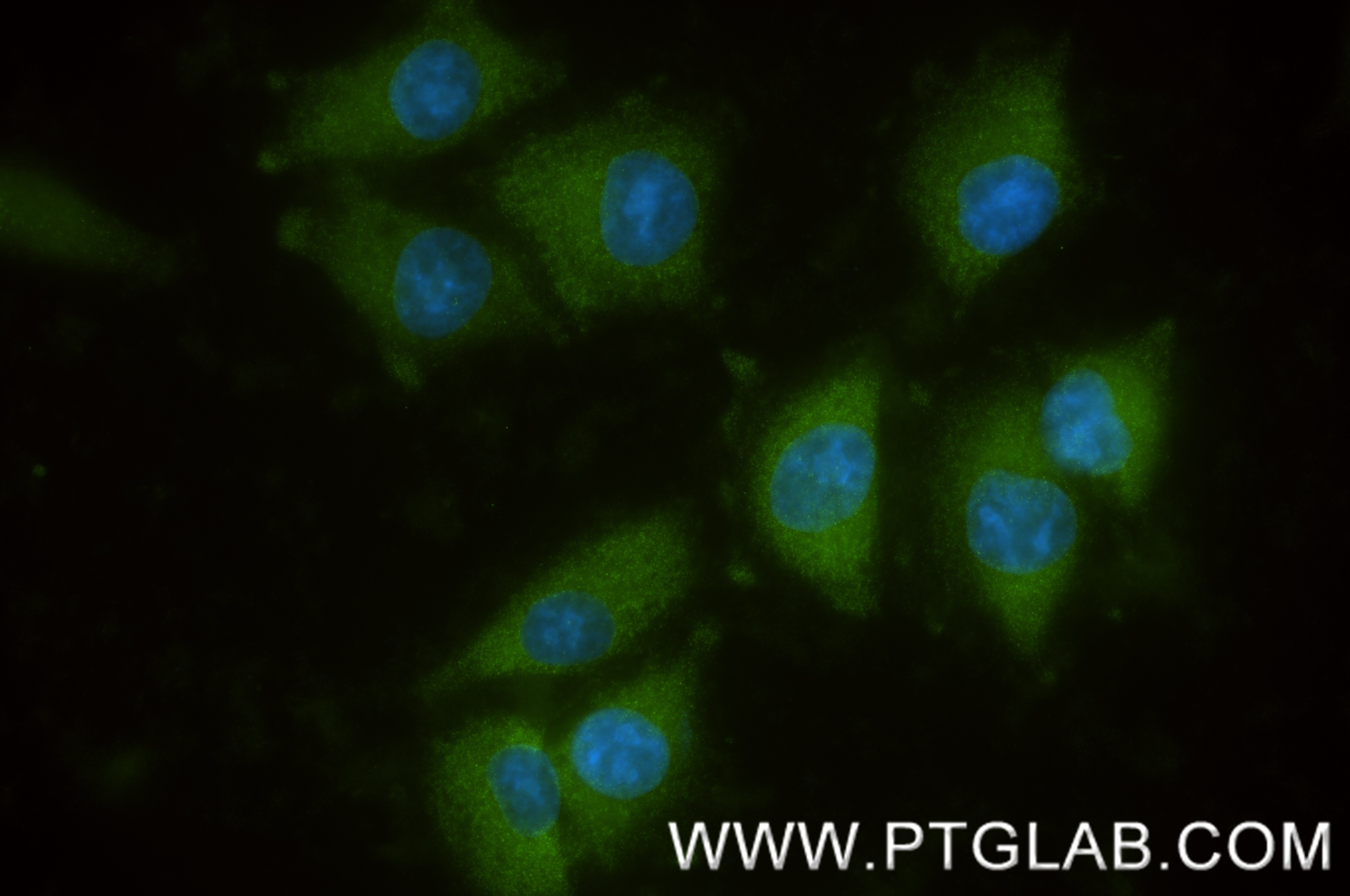 Immunofluorescence (IF) / fluorescent staining of A375 cells using WNK4 Recombinant monoclonal antibody (85886-4-RR)