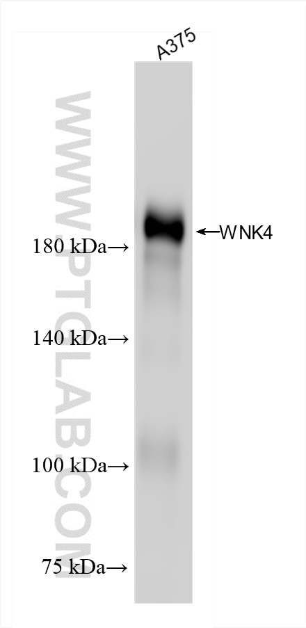 WNK4