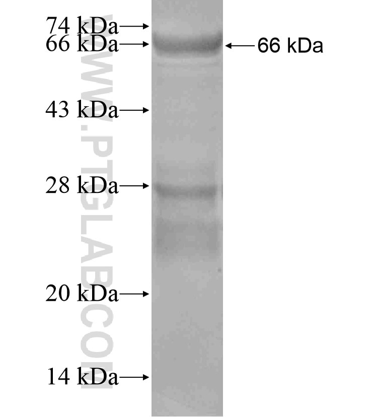 WNK4 fusion protein Ag17773 SDS-PAGE