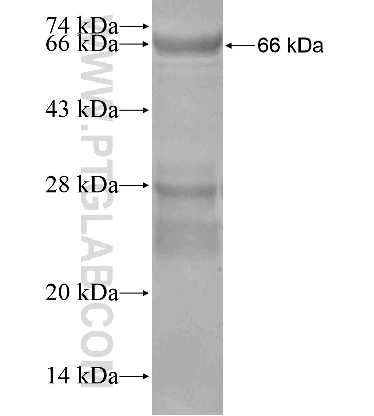 WNK4 fusion protein Ag17773 SDS-PAGE