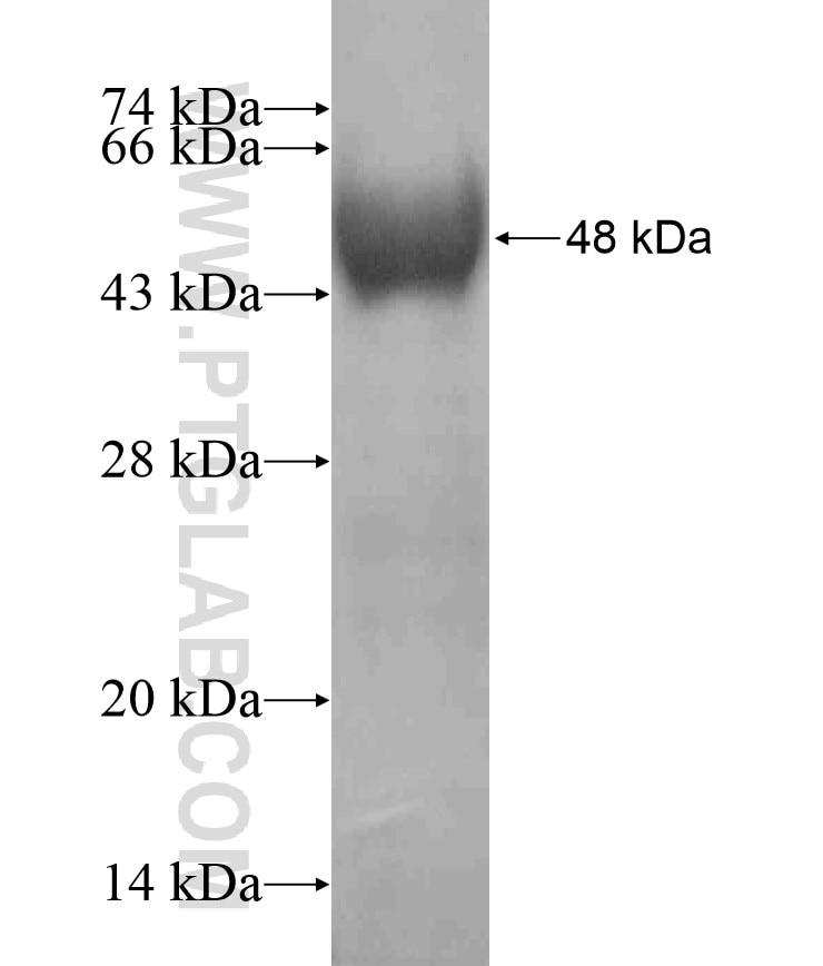 WNK4 fusion protein Ag17879 SDS-PAGE