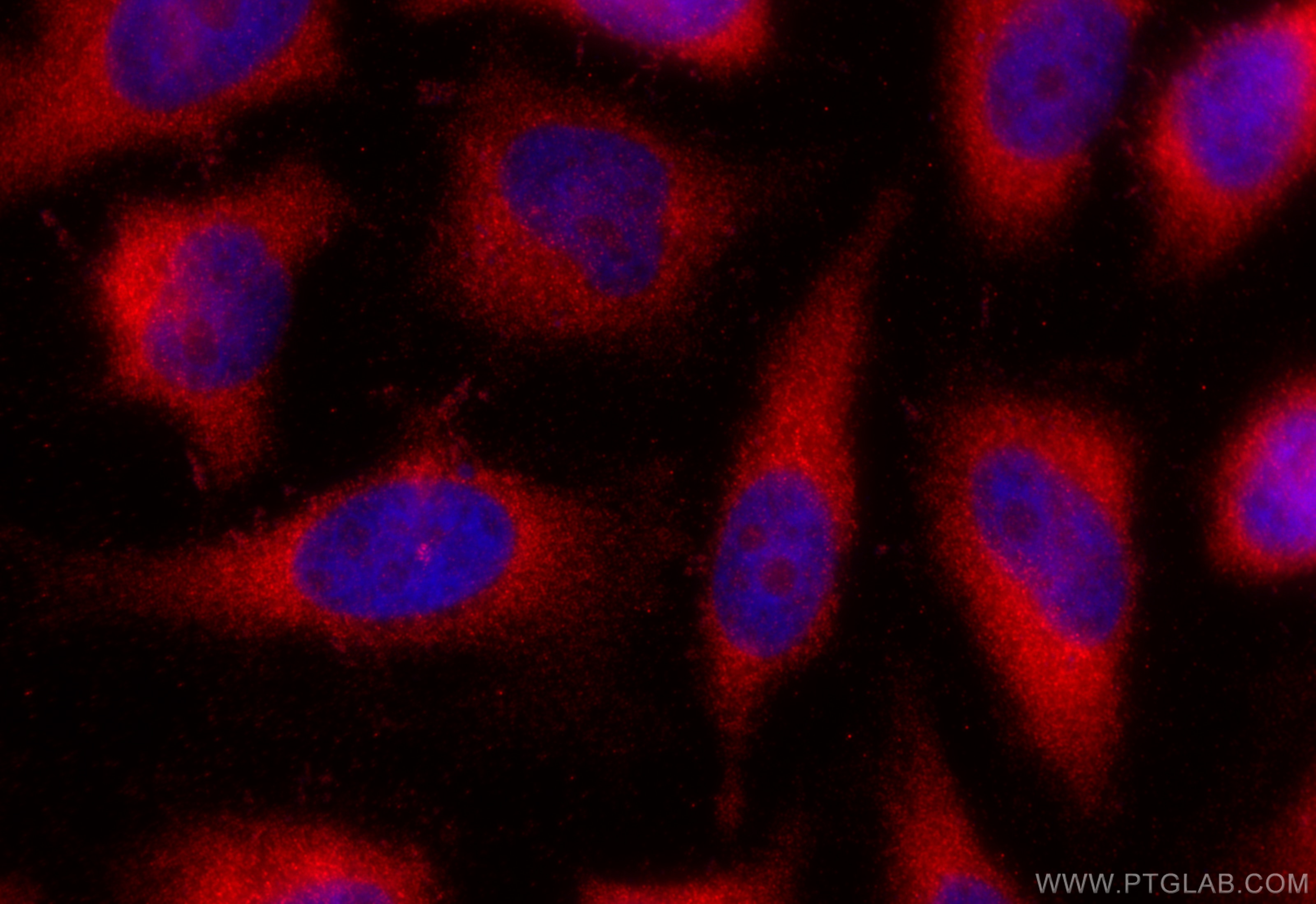 Immunofluorescence (IF) / fluorescent staining of HeLa cells using WNT1 Polyclonal antibody (27935-1-AP)