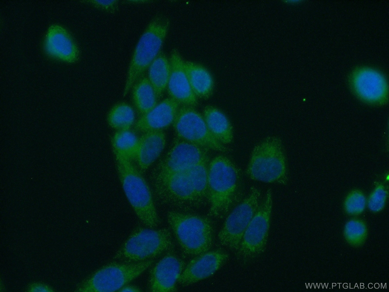 Immunofluorescence (IF) / fluorescent staining of HeLa cells using WNT10A Polyclonal antibody (26238-1-AP)