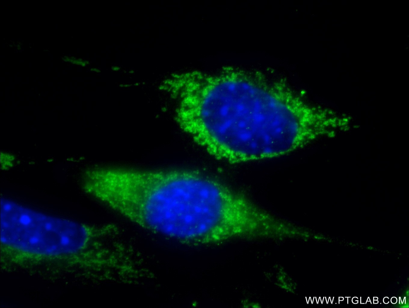 Immunofluorescence (IF) / fluorescent staining of NIH/3T3 cells using WNT10A Polyclonal antibody (26238-1-AP)