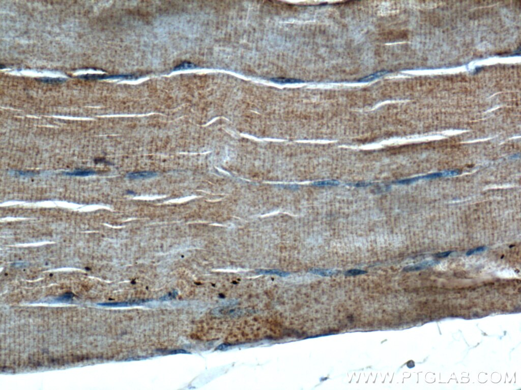 Immunohistochemistry (IHC) staining of human skeletal muscle tissue using WNT10A Polyclonal antibody (26238-1-AP)