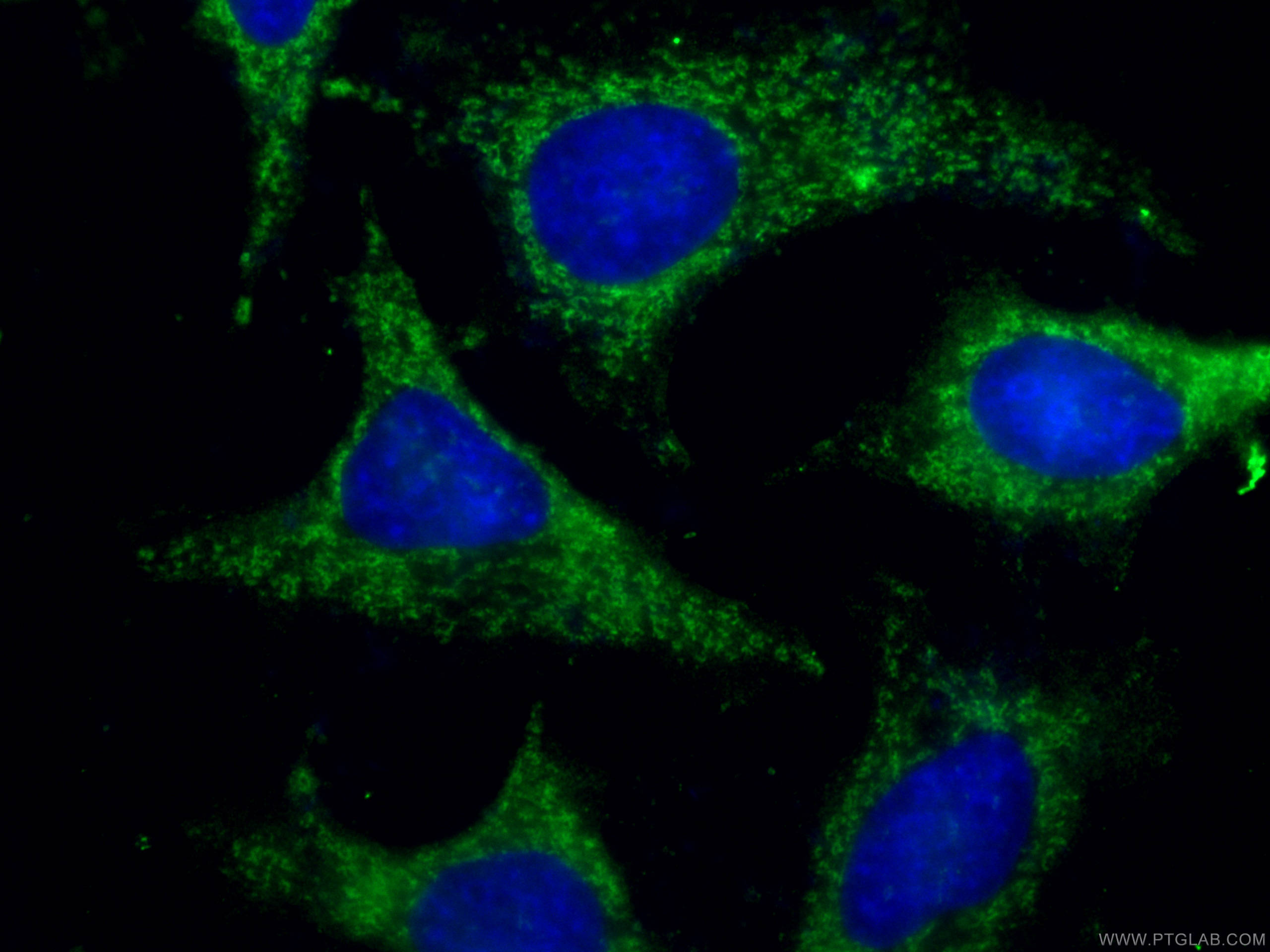 Immunofluorescence (IF) / fluorescent staining of HeLa cells using WNT10B Monoclonal antibody (67210-1-Ig)
