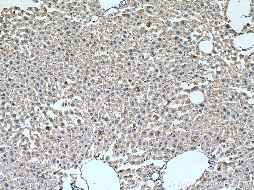 Immunohistochemistry (IHC) staining of mouse liver tissue using WNT10B Monoclonal antibody (67210-1-Ig)