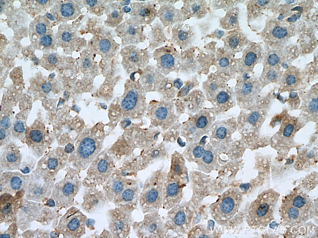 Immunohistochemistry (IHC) staining of mouse liver tissue using WNT10B Monoclonal antibody (67210-1-Ig)
