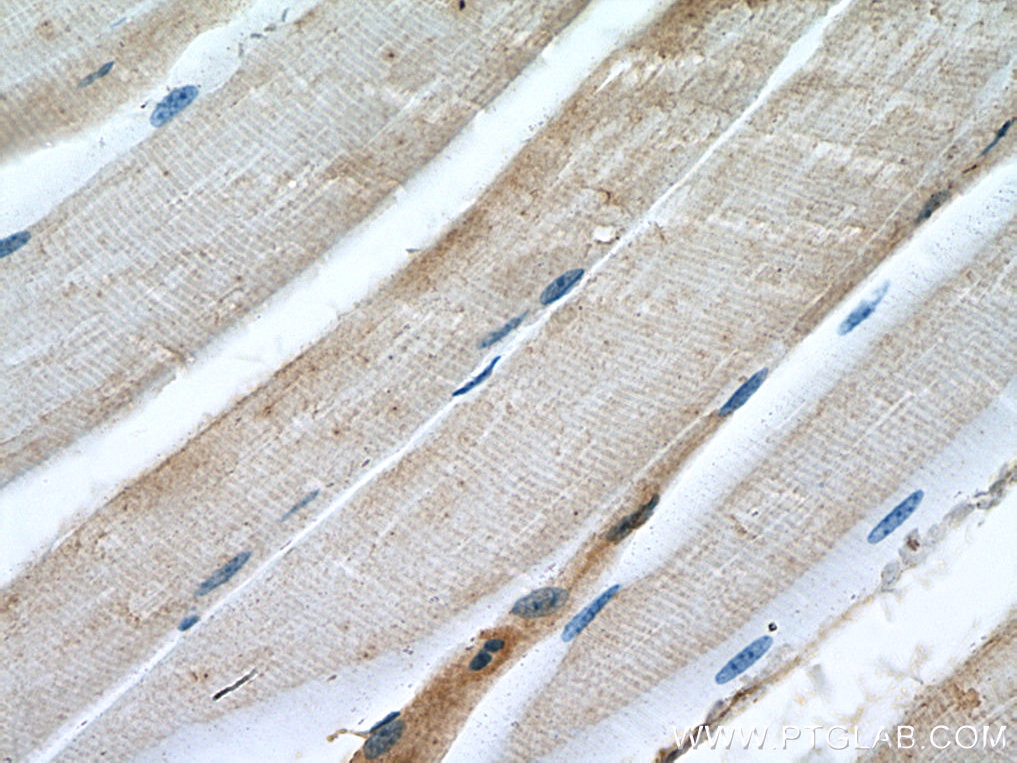 IHC staining of mouse skeletal muscle using 67210-1-Ig