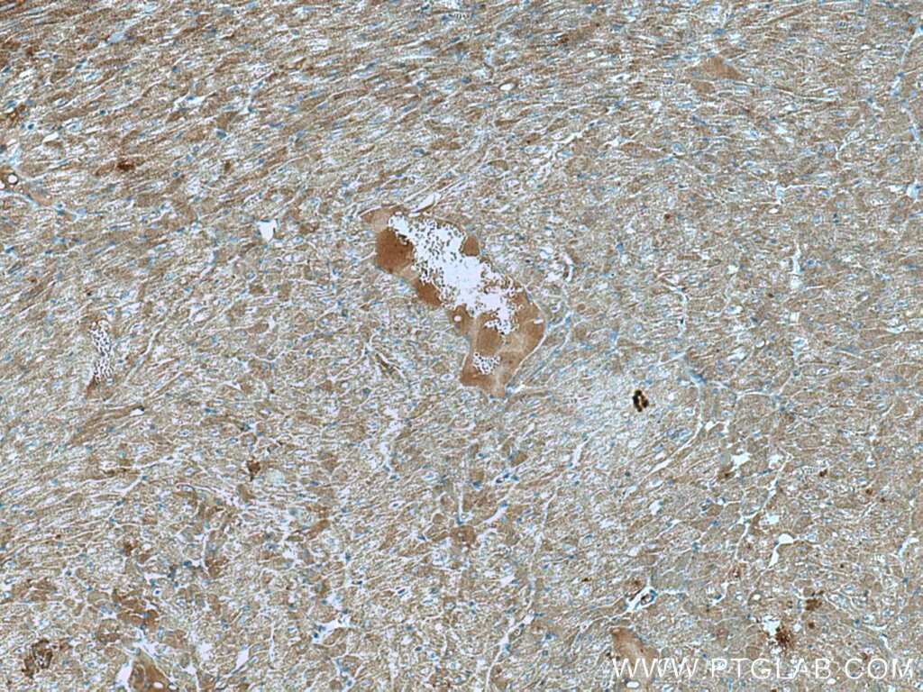 IHC staining of human heart using 67210-1-Ig