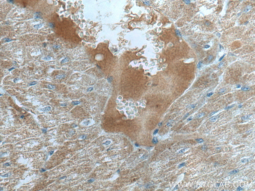 Immunohistochemistry (IHC) staining of human heart tissue using WNT10B Monoclonal antibody (67210-1-Ig)