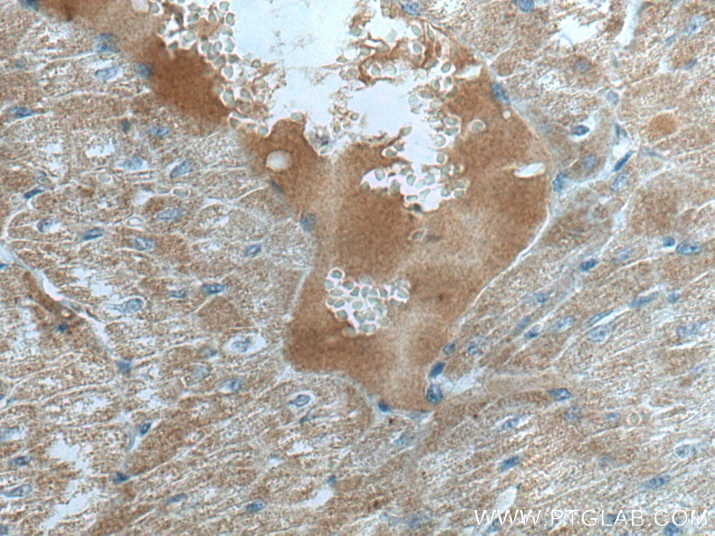 IHC staining of human heart using 67210-1-Ig