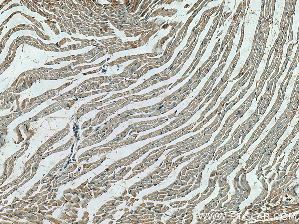 Immunohistochemistry (IHC) staining of mouse heart tissue using WNT10B Monoclonal antibody (67210-1-Ig)
