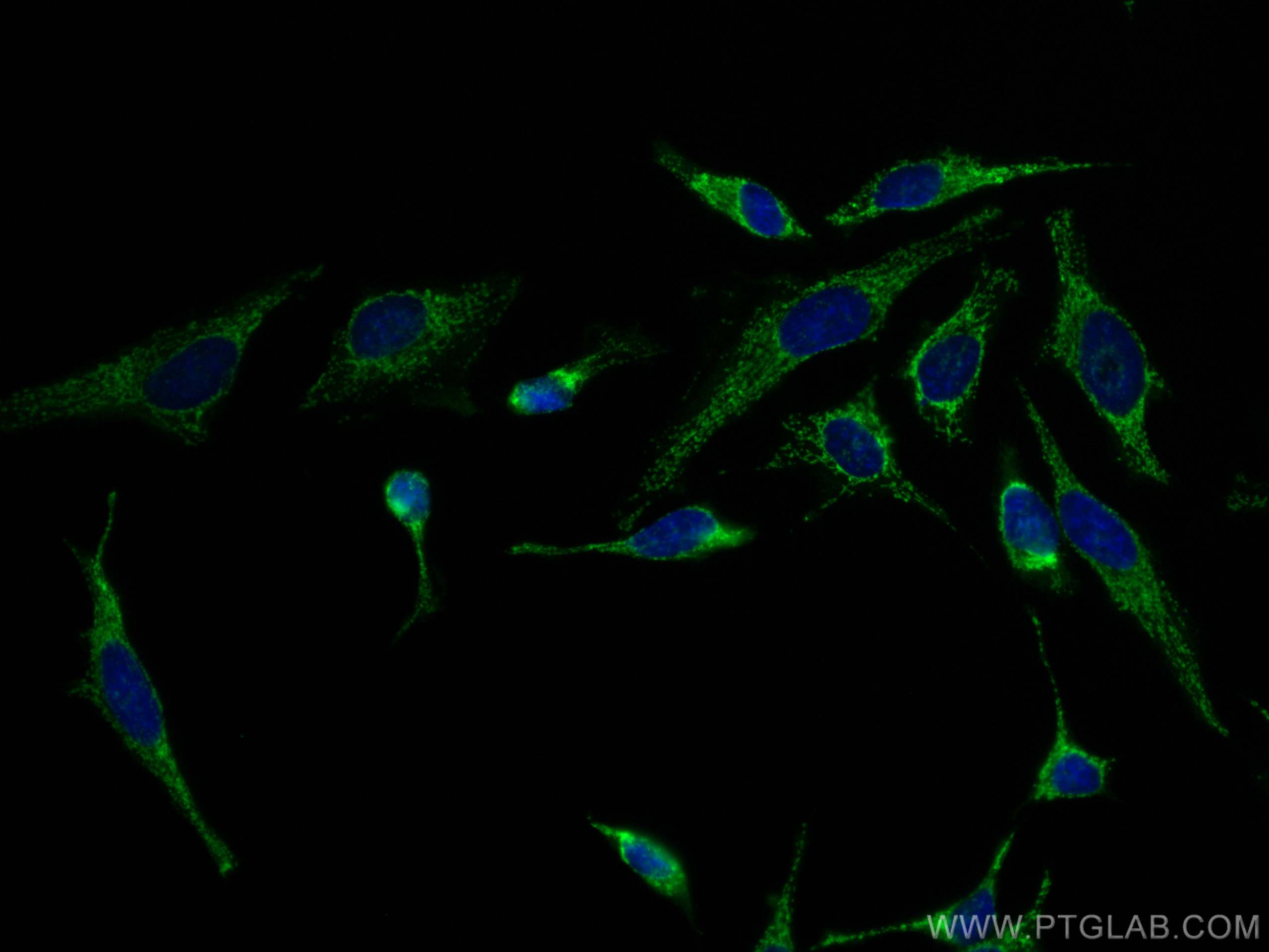 Immunofluorescence (IF) / fluorescent staining of HeLa cells using CoraLite® Plus 488-conjugated WNT10B Monoclonal an (CL488-67210)