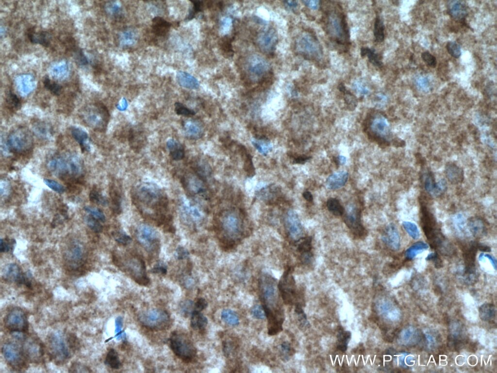 IHC staining of mouse brain using 27214-1-AP