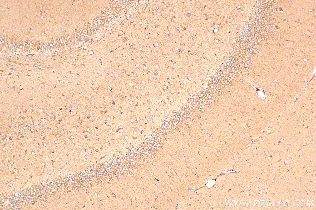 Immunohistochemistry (IHC) staining of rat brain tissue using WNT2 Polyclonal antibody (27214-1-AP)