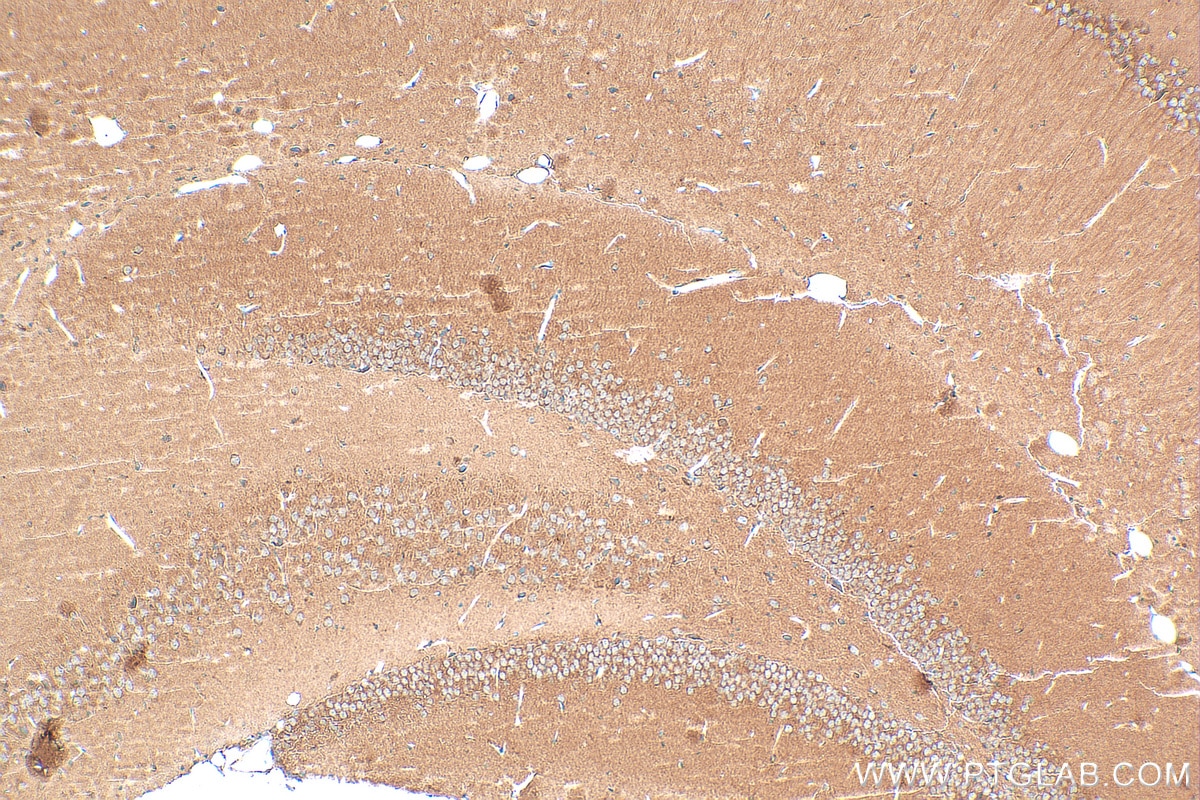 Immunohistochemistry (IHC) staining of mouse brain tissue using WNT2 Polyclonal antibody (27214-1-AP)