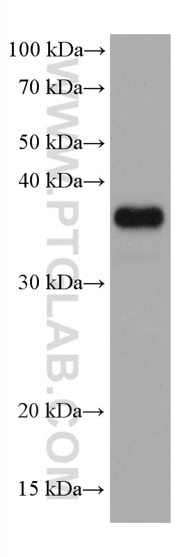 WB analysis of RAW 264.7 using 66656-1-Ig