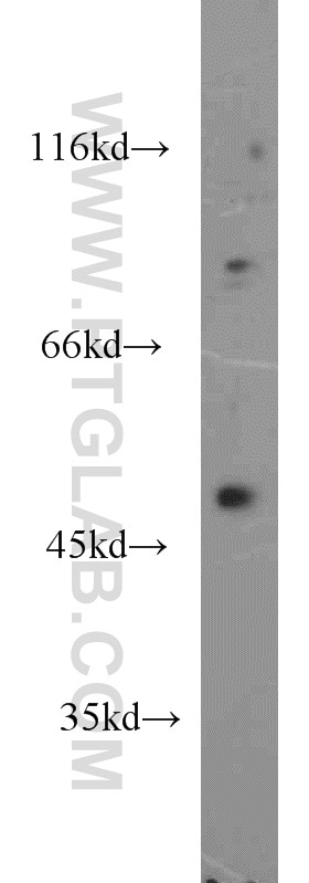 Western Blot (WB) analysis of SH-SY5Y cells using WNT3 Polyclonal antibody (17983-1-AP)