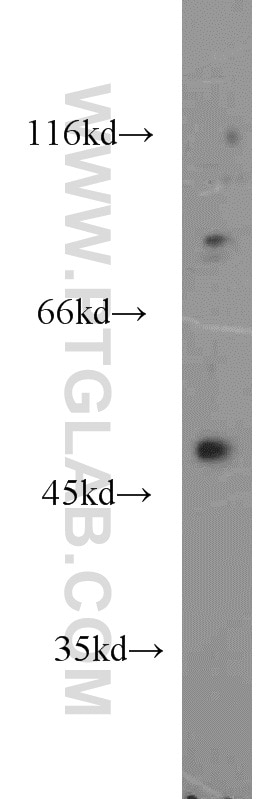 WB analysis of SH-SY5Y using 17983-1-AP