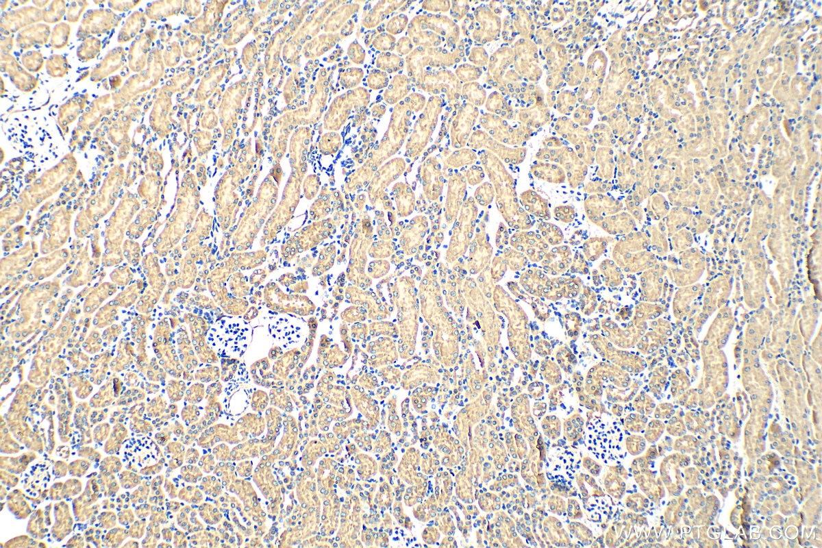 Immunohistochemistry (IHC) staining of mouse kidney tissue using WNT3 Polyclonal antibody (28156-1-AP)