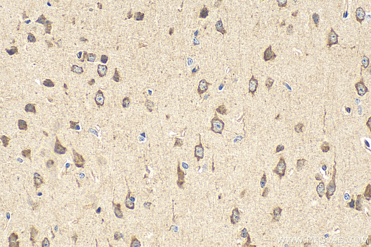 Immunohistochemistry (IHC) staining of mouse brain tissue using WNT3 Polyclonal antibody (28156-1-AP)