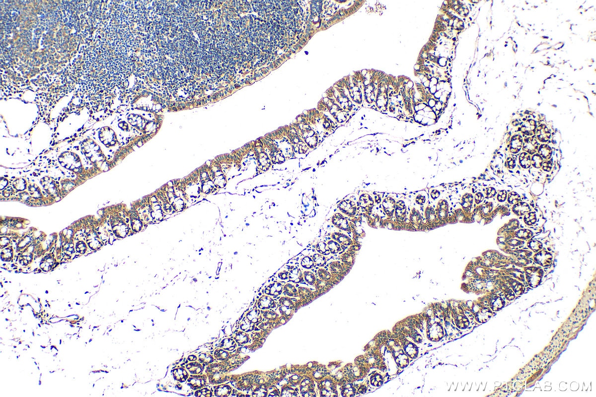 Immunohistochemistry (IHC) staining of mouse colon tissue using WNT3 Polyclonal antibody (28156-1-AP)