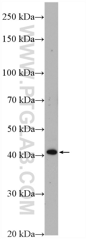 Western Blot (WB) analysis of fetal human brain tissue using WNT3A Polyclonal antibody (26744-1-AP)