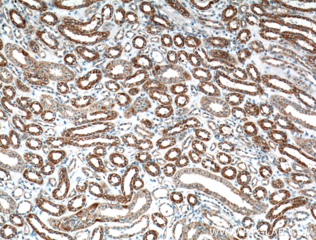 Immunohistochemistry (IHC) staining of human kidney tissue using WNT4 Polyclonal antibody (14371-1-AP)