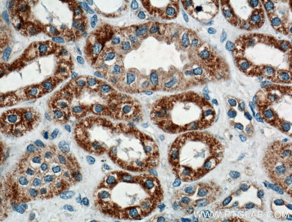 Immunohistochemistry (IHC) staining of human kidney tissue using WNT4 Polyclonal antibody (14371-1-AP)