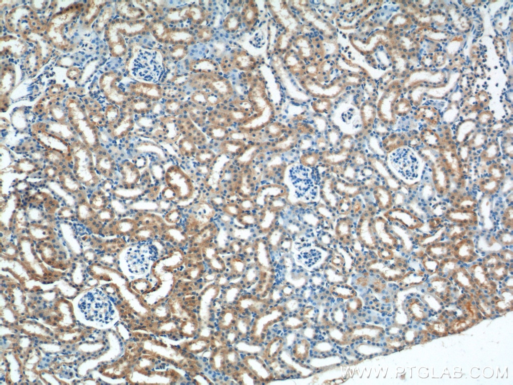 Immunohistochemistry (IHC) staining of mouse kidney tissue using WNT4 Polyclonal antibody (14371-1-AP)