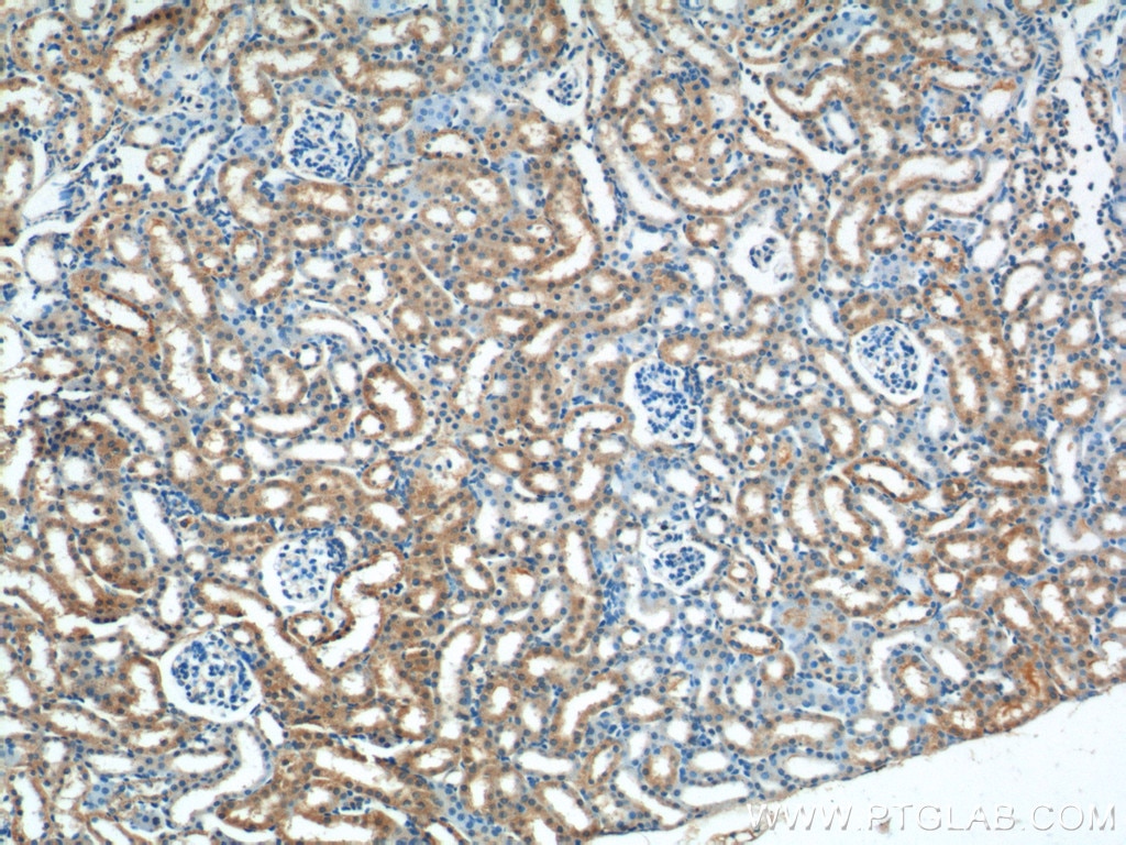 Immunohistochemistry (IHC) staining of mouse kidney tissue using WNT4 Polyclonal antibody (14371-1-AP)