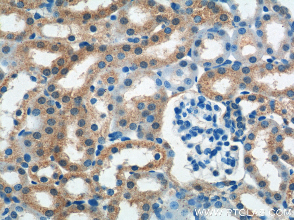 Immunohistochemistry (IHC) staining of mouse kidney tissue using WNT4 Polyclonal antibody (14371-1-AP)