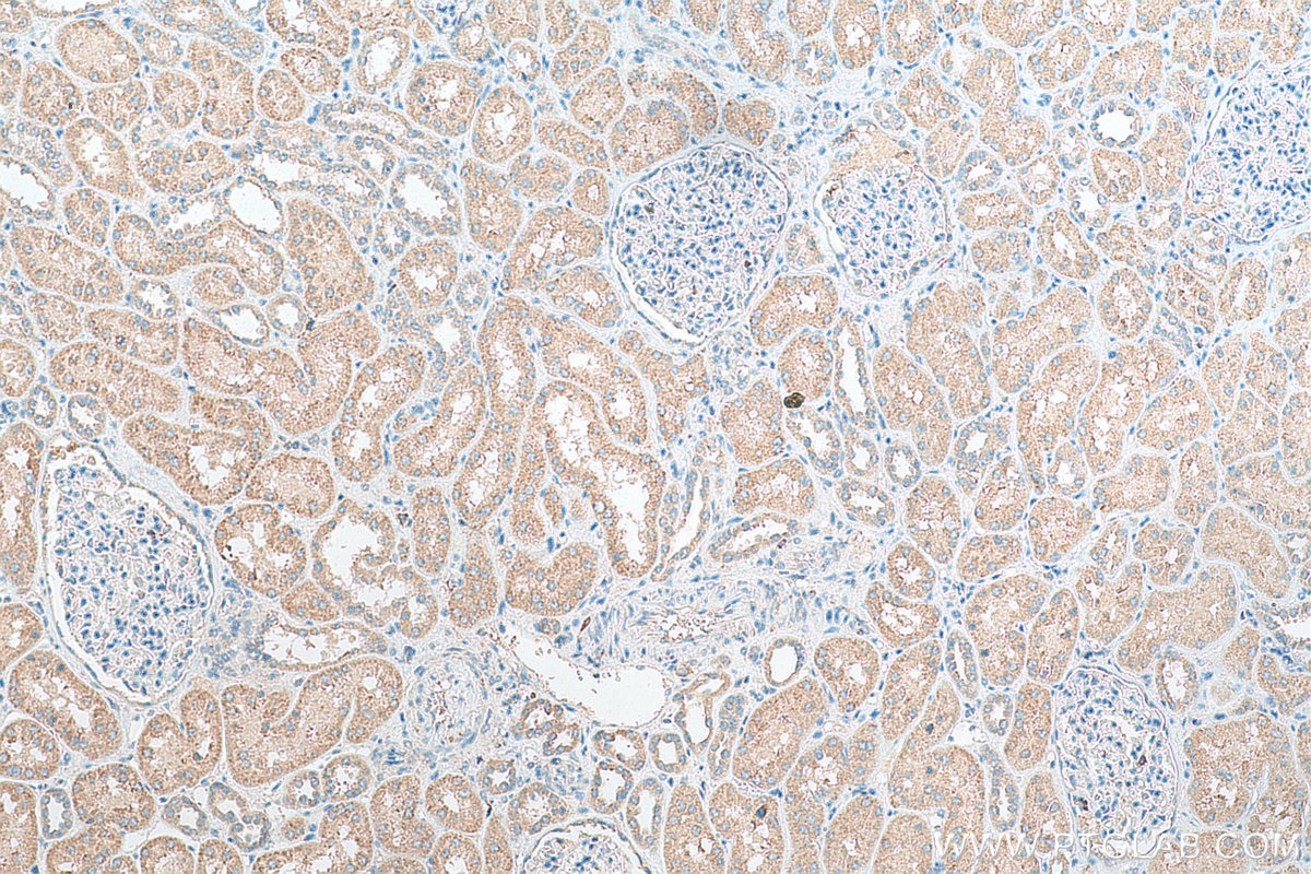 Immunohistochemistry (IHC) staining of human kidney tissue using WNT4 Polyclonal antibody (14371-1-AP)