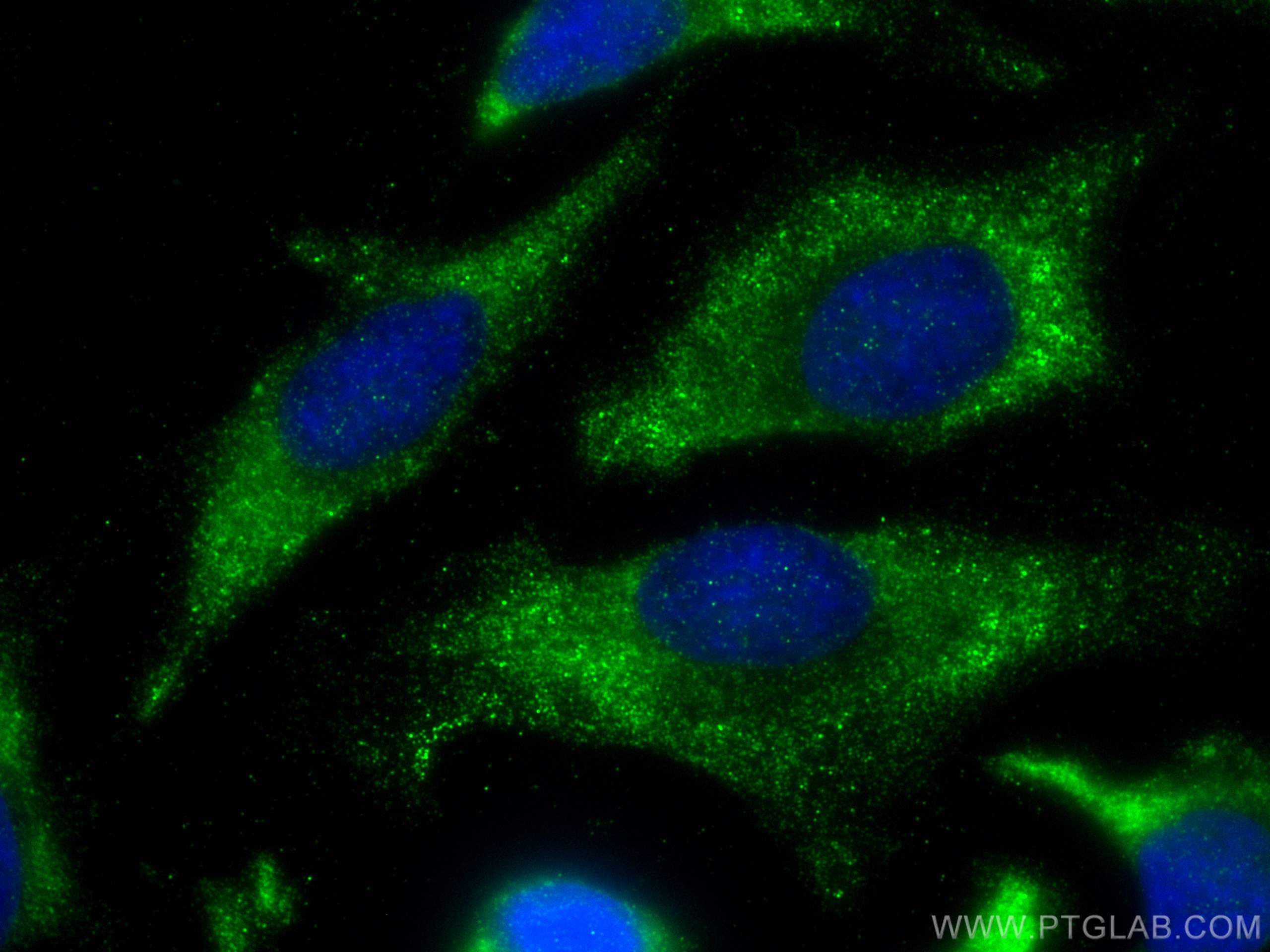 Immunofluorescence (IF) / fluorescent staining of HeLa cells using WNT5A Polyclonal antibody (29793-1-AP)