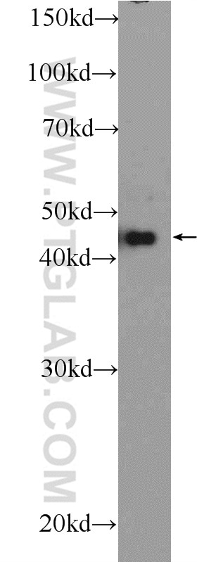 WNT5A/B Polyclonal antibody