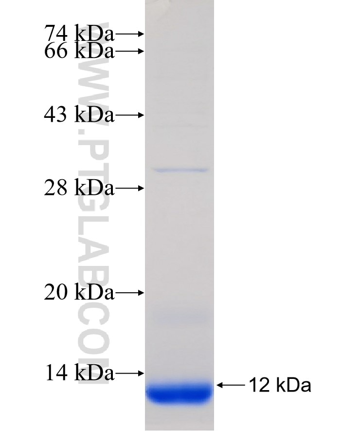 WNT5A fusion protein Ag31520 SDS-PAGE WNT5A fusion protein Ag31520 SDS-PAGE