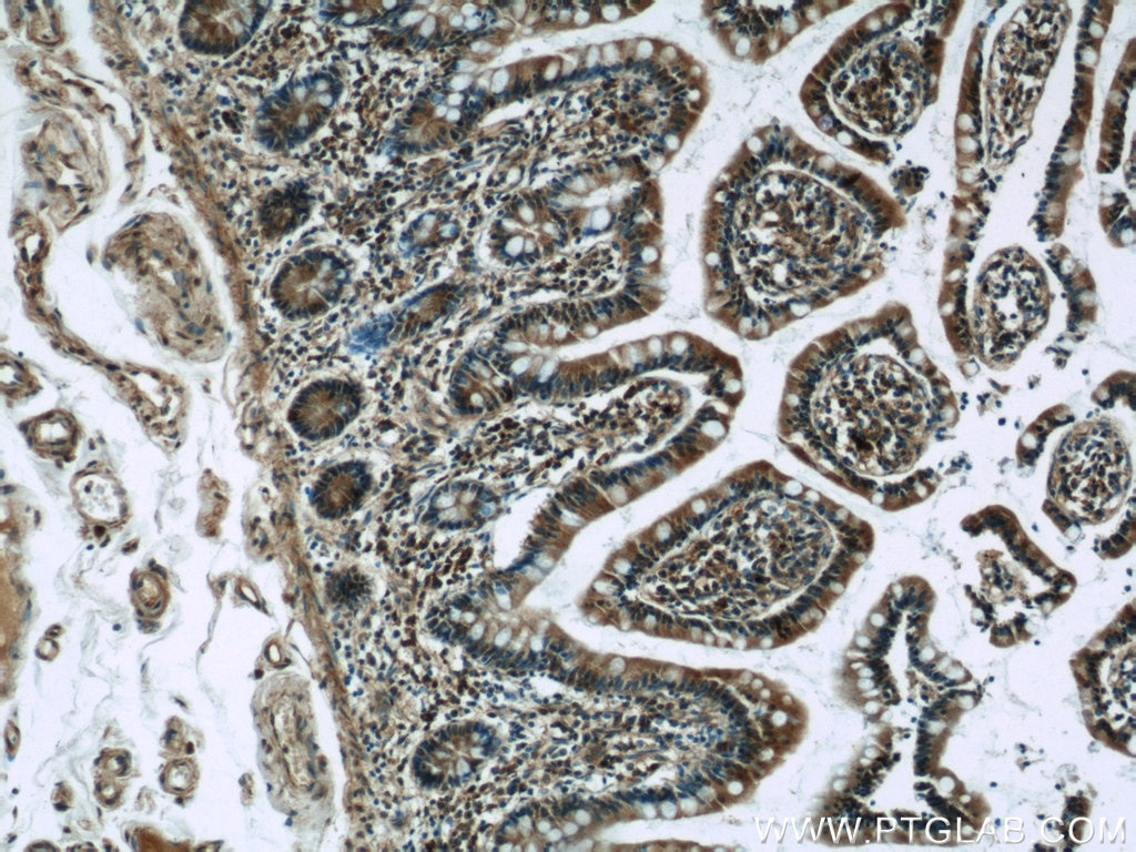 Immunohistochemistry (IHC) staining of human small intestine tissue using WNT6 Polyclonal antibody (24201-1-AP)