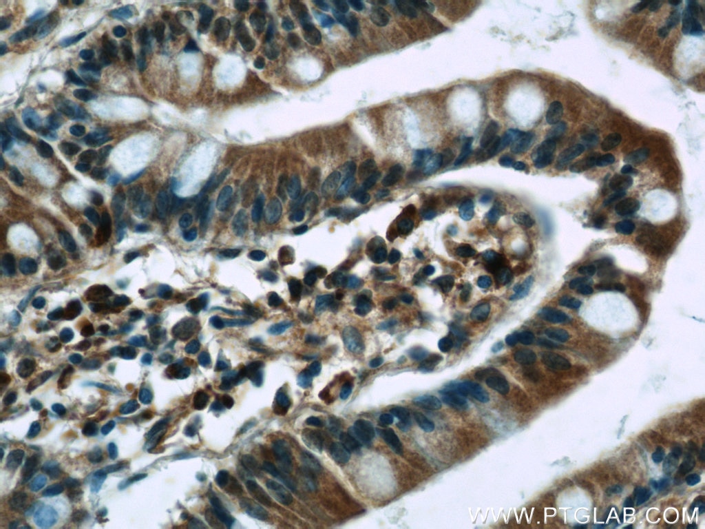 Immunohistochemistry (IHC) staining of human small intestine tissue using WNT6 Polyclonal antibody (24201-1-AP)