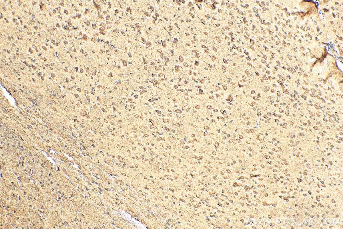Immunohistochemistry (IHC) staining of mouse brain tissue using WNT6 Polyclonal antibody (24201-1-AP)