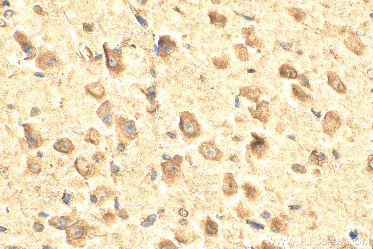 Immunohistochemistry (IHC) staining of mouse brain tissue using WNT6 Polyclonal antibody (24201-1-AP)