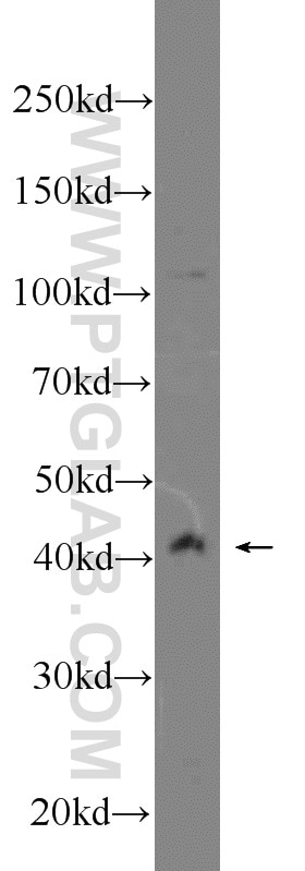 Western Blot (WB) analysis of SGC-7901 cells using WNT6 Polyclonal antibody (24201-1-AP)