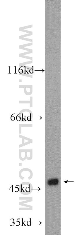 Western Blot (WB) analysis of SGC-7901 cells using WNT6 Polyclonal antibody (24201-1-AP)