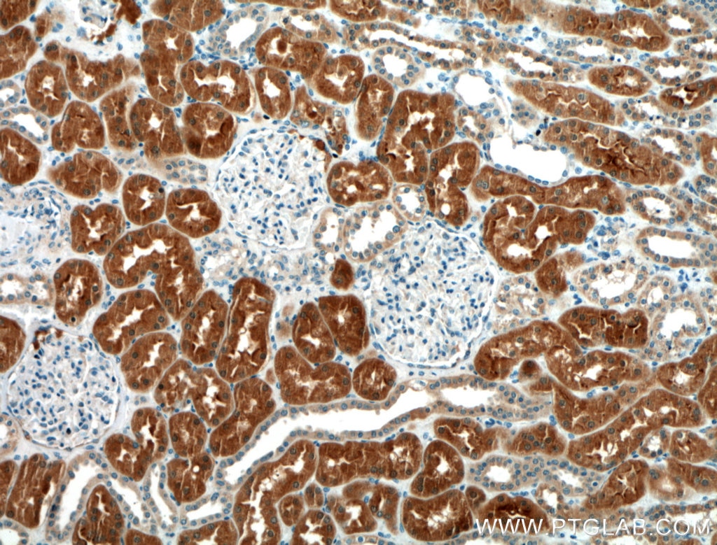 Immunohistochemistry (IHC) staining of human kidney tissue using WNT7A/B Polyclonal antibody (10605-1-AP)