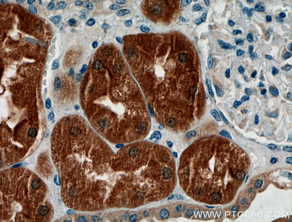 Immunohistochemistry (IHC) staining of human kidney tissue using WNT7A/B Polyclonal antibody (10605-1-AP)