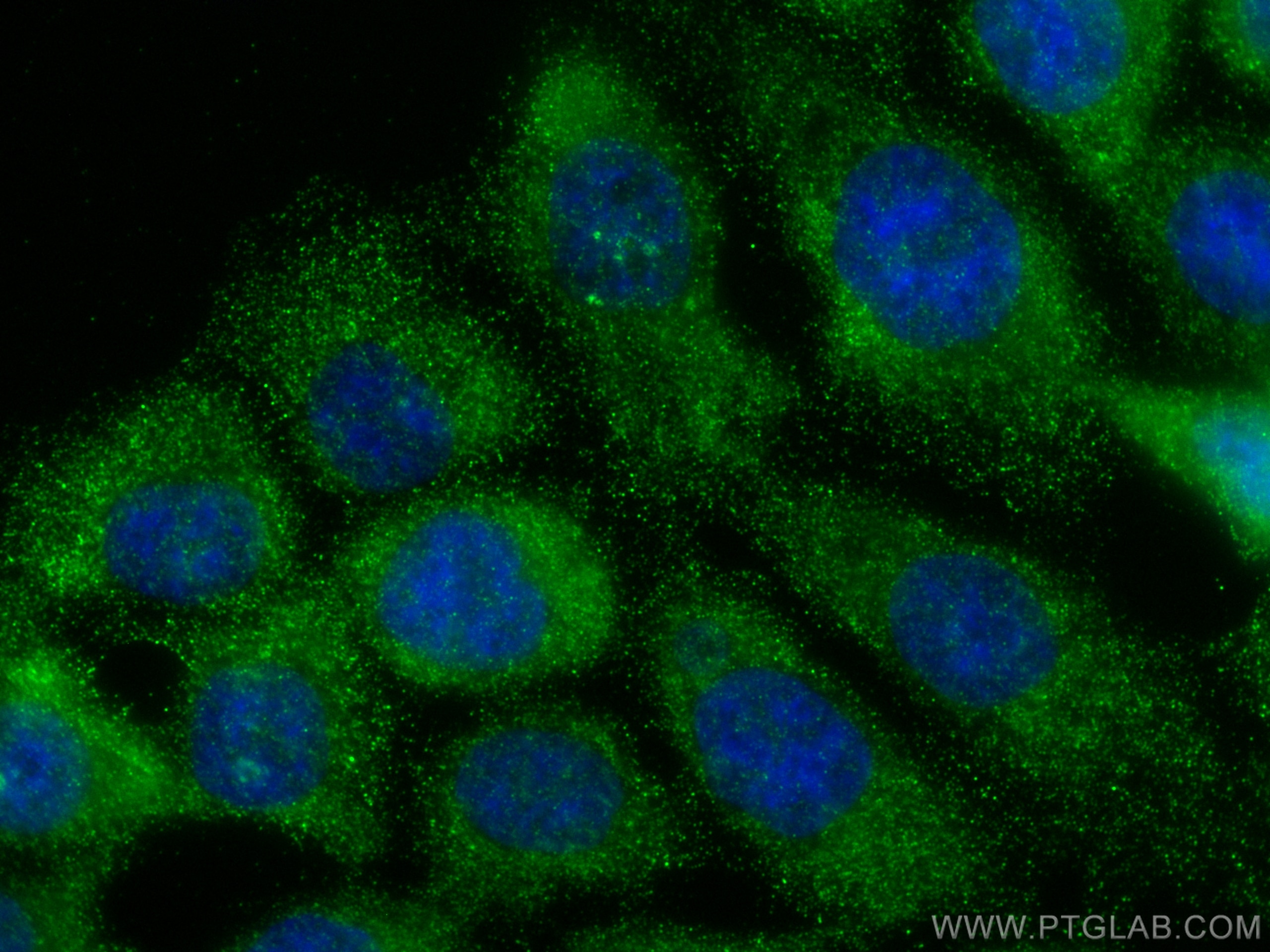 IF Staining of HCT 116 using 30518-1-AP