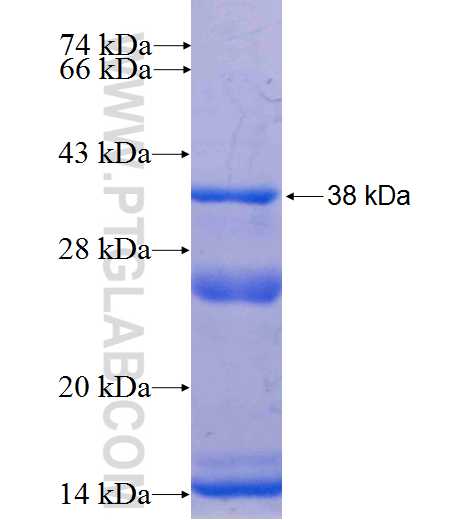WNT9B fusion protein Ag9149 SDS-PAGE