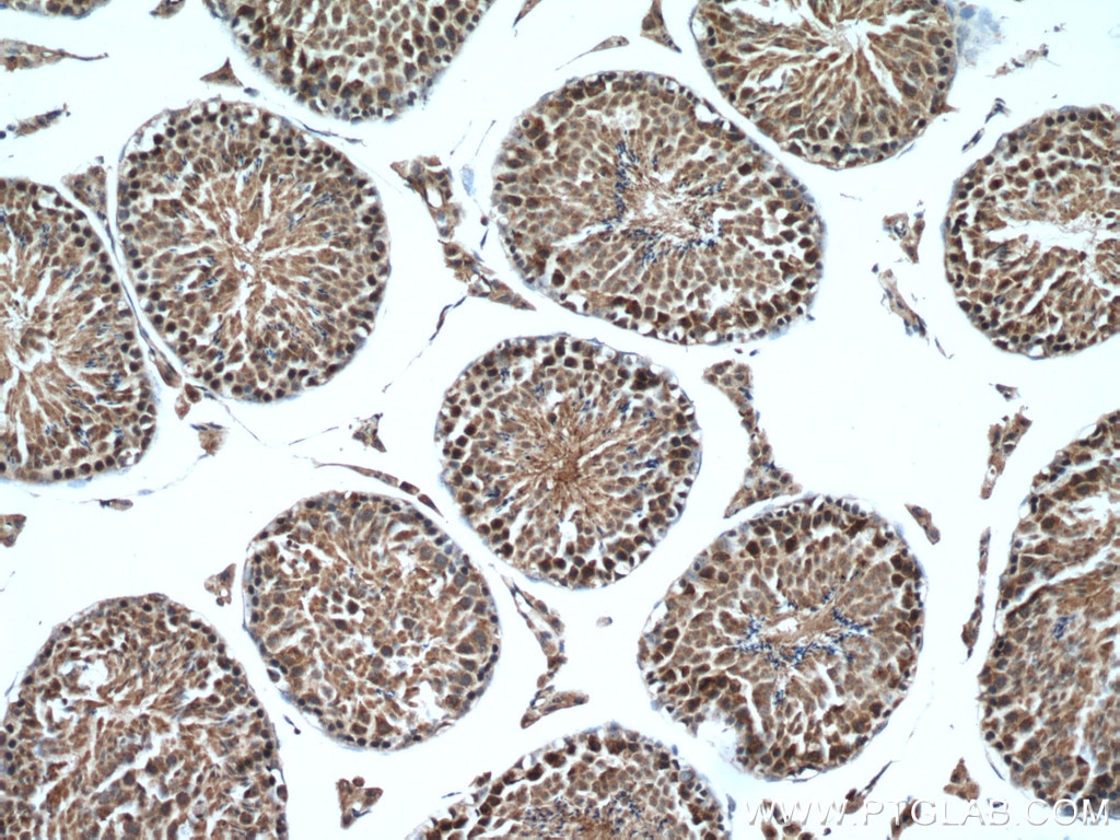 IHC staining of mouse testis using 14761-1-AP