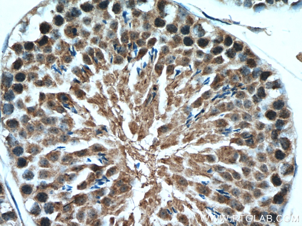 Immunohistochemistry (IHC) staining of mouse testis tissue using WRAP53 Polyclonal antibody (14761-1-AP)